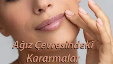 Ağız Çevresi Kararmalar