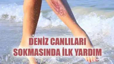 Deniz Canlıları Sokmasında Belirtiler Nelerdir?