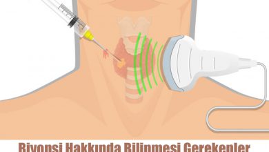 Biyopsi Hakkında Bilinmesi Gerekenler