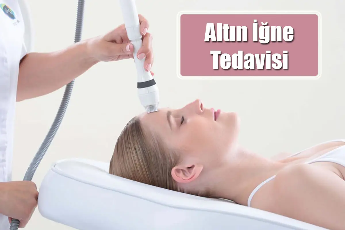 Altın İğne Tedavisi Nedir? Nasıl Yapılır?