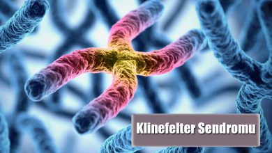 Klinefelter Sendromu Nedir? Sebepleri Nelerdir?