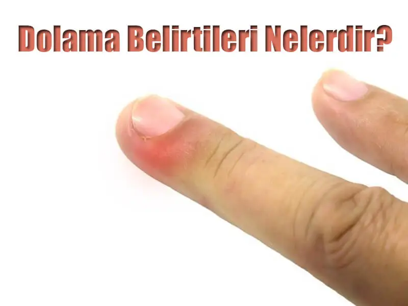 Dolama Belirtileri Nelerdir?