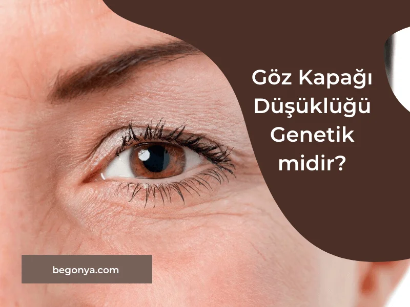 Göz Kapağı Düşüklüğü Genetik midir?