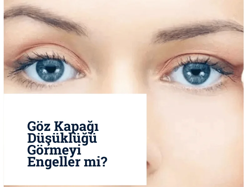 Göz Kapağı Düşüklüğü Görmeyi Engeller mi?