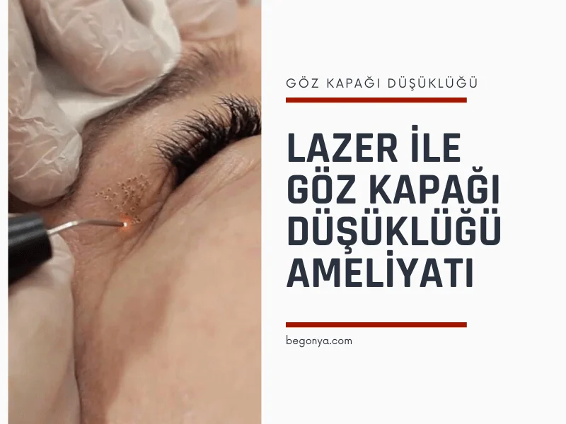 Lazer ile Göz Kapağı Düşüklüğü Ameliyatı