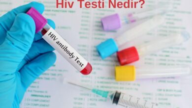 Hiv Testi Nedir?